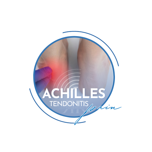 Achilles Tendonitis pain relief using Shockwave Therapy in Roswell, Georgia, serving Alpharetta, Sandy Springs, Milton, Johns Creek.