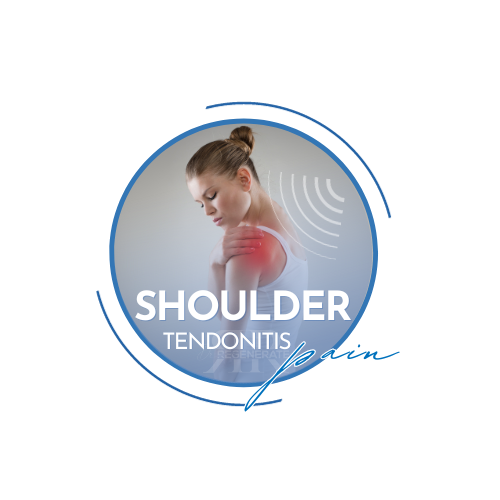 Shockwave therapy for shoulder pain relief in Roswell, Alpharetta, Sandy Springs, Milton, and Johns Creek