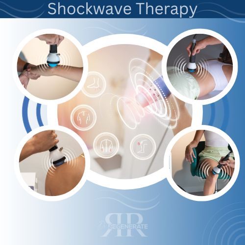 Shockwave Therapy for Pain Relief in Roswell, GA - Treating Shoulders, Wrists, Back, and Knee Pain.